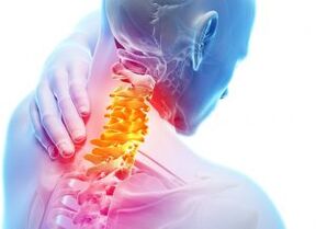 Dolor y adaptación en la zona del cuello uterino con el tercer grado de osteocondrosis