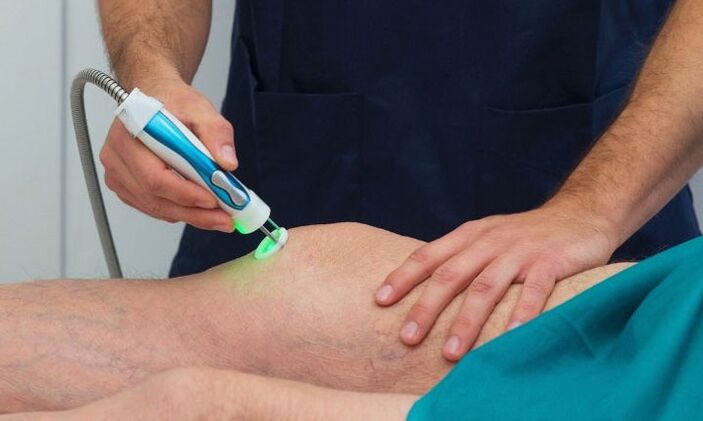 Termografía de la articulación de la rodilla en artrosis